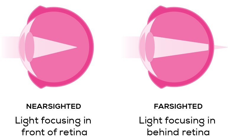 NearvsFar Support Image