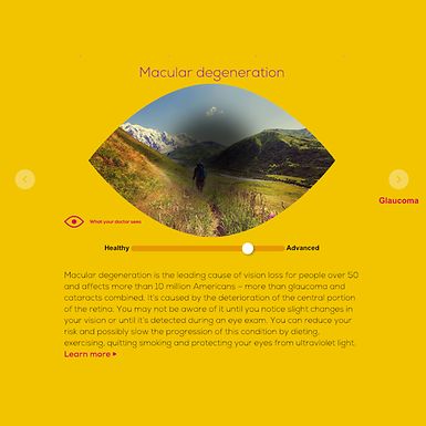 Screenshot of the vision simulator, showing a macular degeneration diagram.